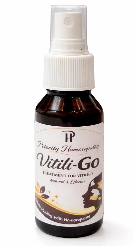 vitiligo spray