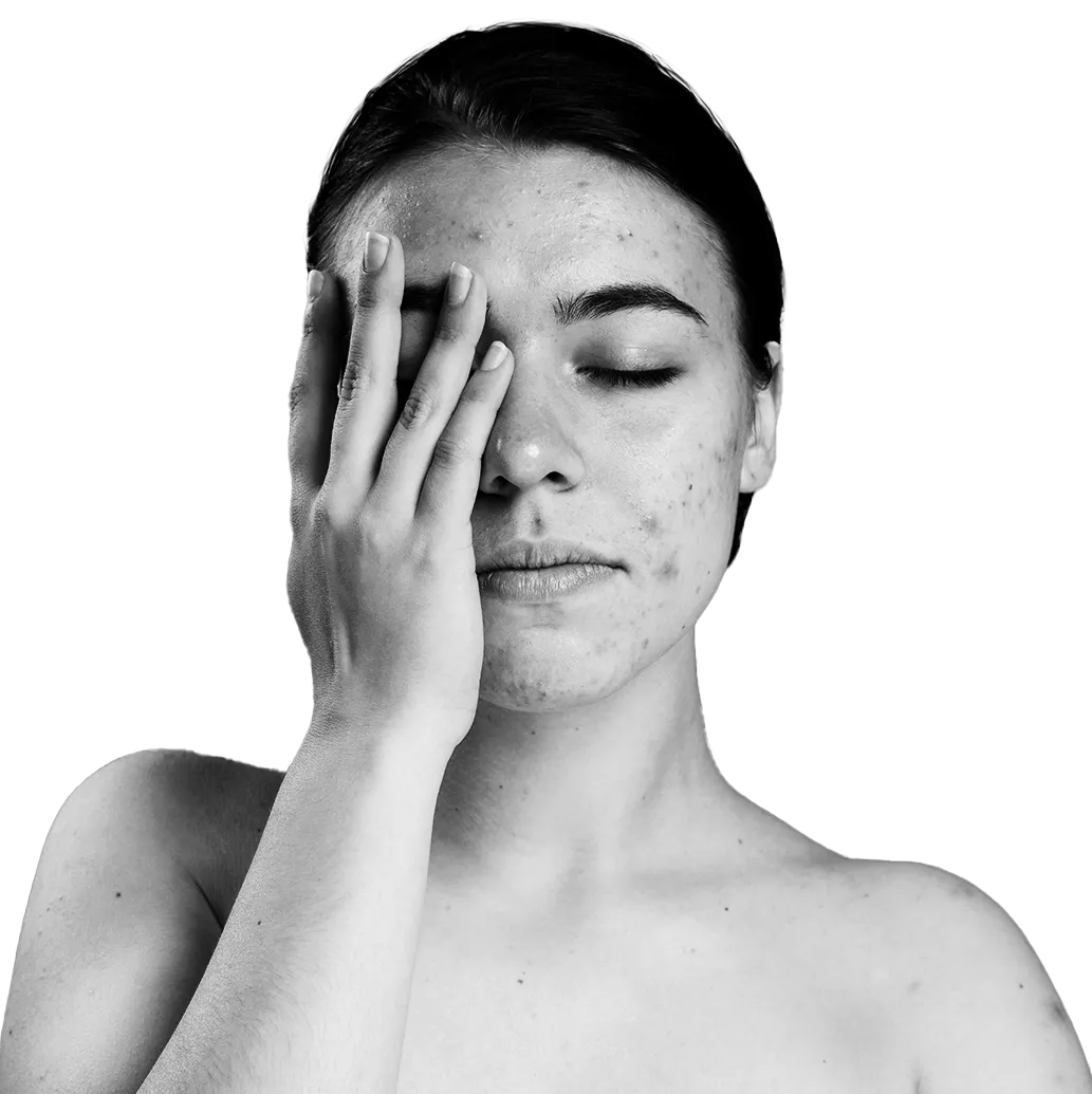 Homeopathy Treatment